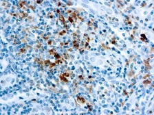 Anti-Granzyme B antibody used in IHC (Paraffin sections) (IHC-P). GTX24059