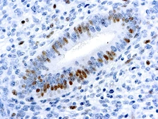 Anti-E2F1 antibody [KH95] used in IHC (Paraffin sections) (IHC-P). GTX24070