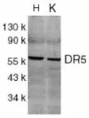 Anti-DR5 antibody used in Western Blot (WB). GTX24106
