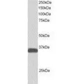 Anti-ALS2CR2 antibody used in Western Blot (WB). GTX24122