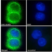 Anti-ALMS1 antibody used in Immunocytochemistry/ Immunofluorescence (ICC/IF). GTX24306