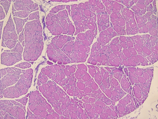 Human Skeletal muscle (Normal) tissue slides. GTX24366