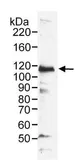 Anti-MCM3 antibody used in Western Blot (WB). GTX24460