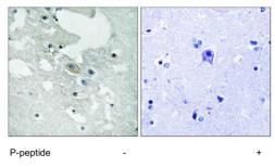 Anti-BLNK (phospho Tyr84) antibody used in IHC (Paraffin sections) (IHC-P). GTX24474
