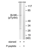 Anti-BLNK (phospho Tyr84) antibody used in Western Blot (WB). GTX24474