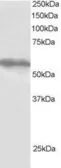 Anti-TRIM4 antibody used in Western Blot (WB). GTX24527