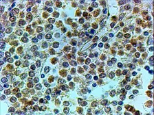 Anti-TRIP antibody, C-term used in IHC (Paraffin sections) (IHC-P). GTX24533
