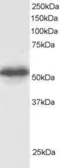 Anti-CSN1 antibody, C-term used in Western Blot (WB). GTX24535