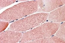 Anti-TRIM7 antibody, C-term used in IHC (Paraffin sections) (IHC-P). GTX24541