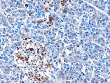 Anti-MDA5 antibody, N-term used in IHC (Paraffin sections) (IHC-P). GTX24544