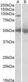 Anti-USP6 antibody, C-term used in Western Blot (WB). GTX24553