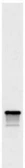 Anti-Nop1p antibody [28F2] used in Western Blot (WB). GTX24575