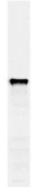 Anti-PDI1 antibody [38H8] used in Western Blot (WB). GTX24644