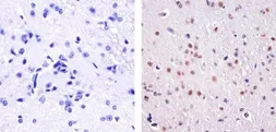 Anti-ATF2 (phospho Thr71) antibody used in IHC (Paraffin sections) (IHC-P). GTX24736