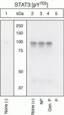 Anti-STAT3 (phospho Tyr705) antibody used in Western Blot (WB). GTX24740