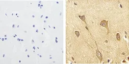 Anti-Tau (phospho Ser199) antibody used in IHC (Paraffin sections) (IHC-P). GTX24749