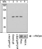 Anti-Raf1 (phospho Ser621) antibody used in Western Blot (WB). GTX24767