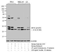 Anti-eIF4E (phospho Ser209) antibody used in Western Blot (WB). GTX24774