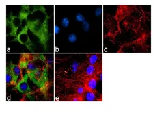 Anti-eIF4E (phospho Ser209) antibody used in Immunocytochemistry/ Immunofluorescence (ICC/IF). GTX24774