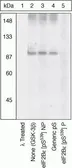Anti-EIF2B epsilon (phospho Ser539) antibody used in Western Blot (WB). GTX24775