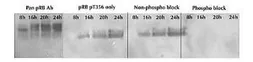 Anti-Rb (phospho Thr356) antibody used in Western Blot (WB). GTX24780