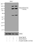 Anti-Rb (phospho Ser249) antibody used in Western Blot (WB). GTX24788