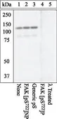 Anti-FAK (phospho Ser722) antibody used in Western Blot (WB). GTX24790