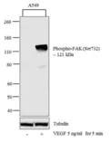 Anti-FAK (phospho Ser732) antibody used in Western Blot (WB). GTX24792