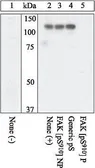 Anti-FAK (phospho Ser910) antibody used in Western Blot (WB). GTX24794