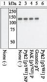 Anti-PYK2 (phospho Tyr881) antibody used in Western Blot (WB). GTX24801