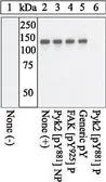 Anti-PYK2 (phospho Tyr881) antibody used in Western Blot (WB). GTX24801