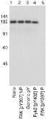 Anti-FAK (phospho Tyr397) antibody used in Western Blot (WB). GTX24803