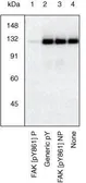 Anti-FAK (phospho Tyr861) antibody used in Western Blot (WB). GTX24804