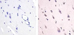 Anti-PYK2 (phospho Tyr579) antibody used in IHC (Paraffin sections) (IHC-P). GTX24805