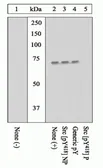 Anti-Src (phospho Tyr416) antibody used in Western Blot (WB). GTX24816