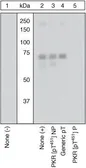 Anti-PKR (phospho Thr451) antibody used in Western Blot (WB). GTX24818