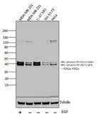 Anti-ERK1 (phospho Thr202/Tyr204) + ERK2 (phospho Thr185/Tyr187) antibody used in Western Blot (WB). GTX24819