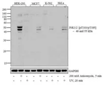 Anti-JNK (phospho Thr183/Tyr185) antibody used in Western Blot (WB). GTX24821