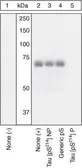 Anti-Tau (phospho Ser214) antibody used in Western Blot (WB). GTX24846