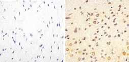 Anti-Tau (phospho Thr217) antibody used in IHC (Paraffin sections) (IHC-P). GTX24851