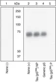 Anti-Tau (phospho Ser396) antibody used in Western Blot (WB). GTX24858