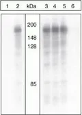 Anti-IRS1 (phospho Ser312) antibody used in Western Blot (WB). GTX24865