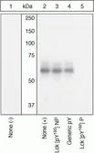 Anti-Lck (phospho Tyr192) antibody used in Western Blot (WB). GTX24900