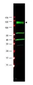 Anti-FANCA antibody used in Western Blot (WB). GTX25063