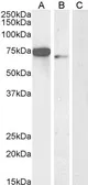 Anti-FOXC1 antibody, C-term used in Western Blot (WB). GTX25079