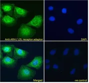 Anti-ARH antibody, N-term used in Immunocytochemistry/ Immunofluorescence (ICC/IF). GTX25082