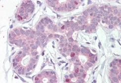 Anti-FOXA1 antibody, C-term used in IHC (Paraffin sections) (IHC-P). GTX25089