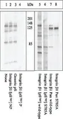 Anti-Integrin beta 1 / CD29 (phospho Ser785) antibody used in Western Blot (WB). GTX25185
