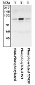 Anti-Integrin beta 3 (phospho Tyr785) antibody used in Immunoprecipitation (IP). GTX25191
