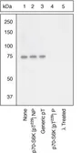 Anti-p70 S6K (phospho Thr229) antibody used in Western Blot (WB). GTX25231